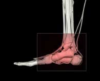 Ankle Sprain & Football 
