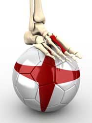 Metatarsal Fracture & Football